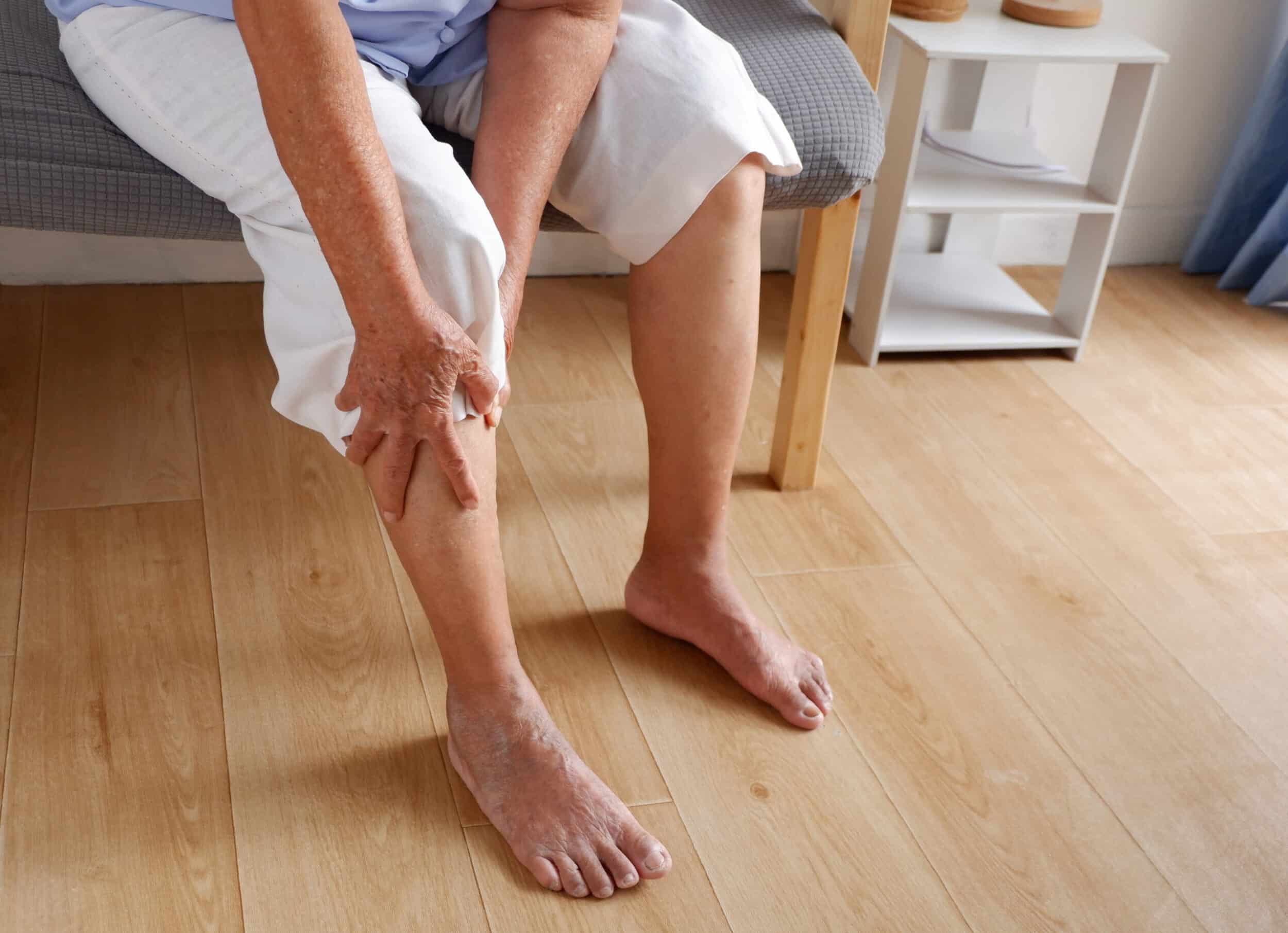 Woman holds her leg, which is cramping painfully due to varicose veins