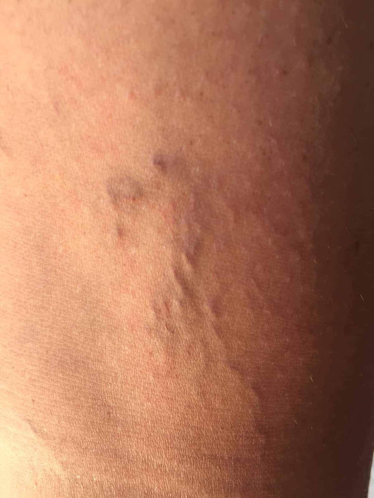 Closeup of veins